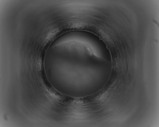 X0000093580640200710151146