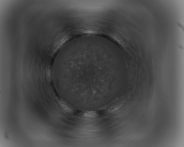 X0000093580720200710151145