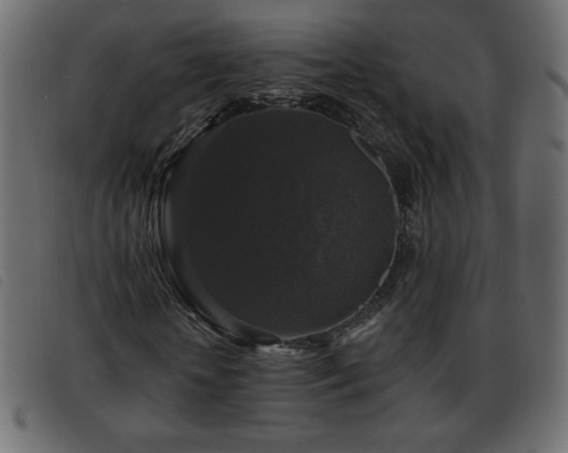 X0000093580818200710151143
