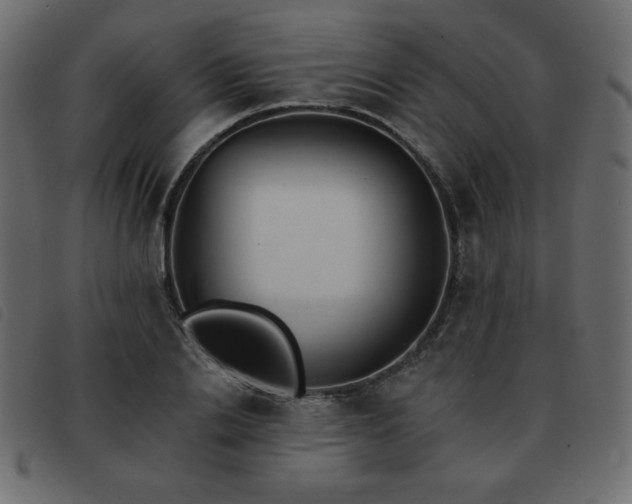 X0000093580838200710151143
