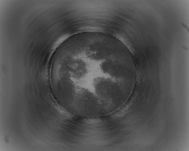 X0000093581074200710151140