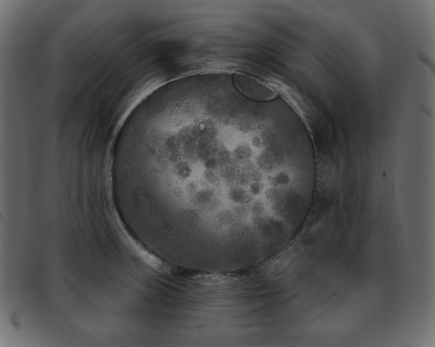 X0000093581235200710151139