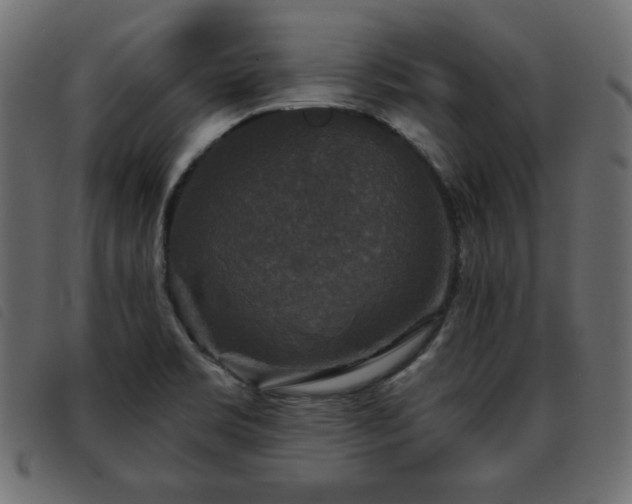 X0000093581469200710151136