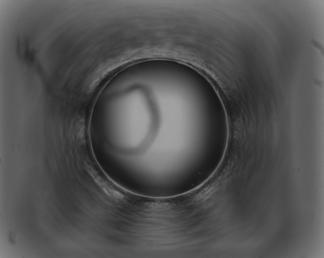 X0000093581499200710151135