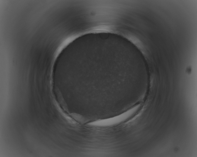 X0000093581469200710221454