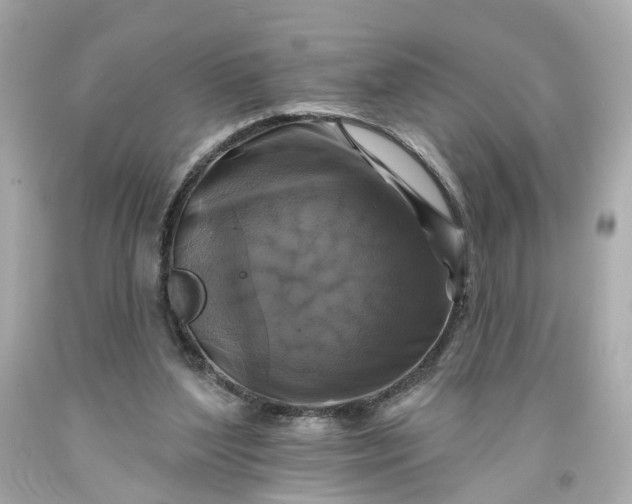 X0000093580204200710291108