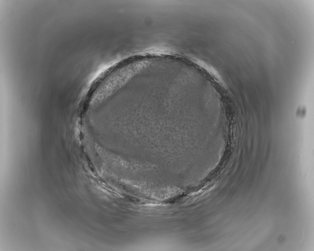 X0000093581160200710291055