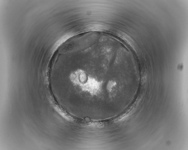 X0000093581026200711051114