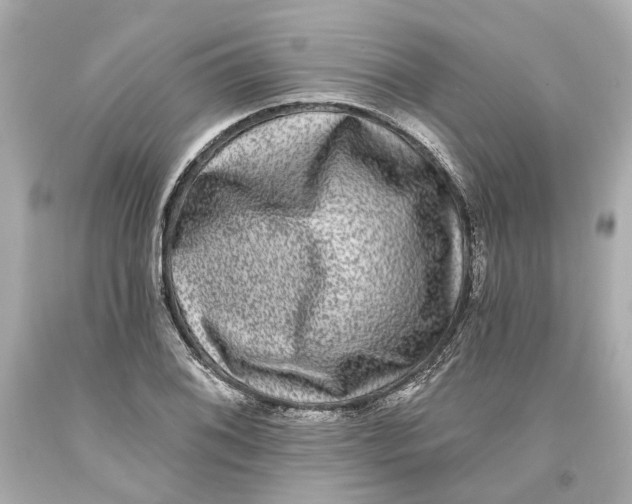 X0000093581076200711051113