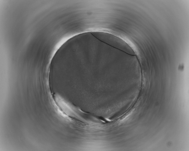 X0000093581102200711051113