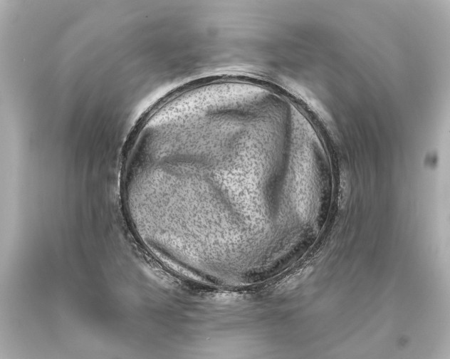 X0000093581316200711051110