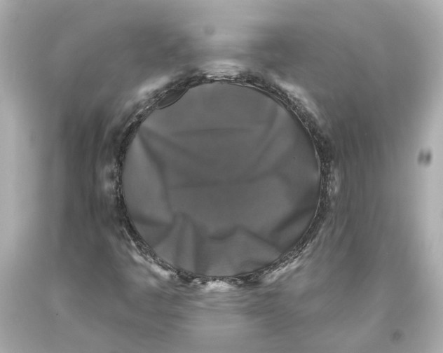 X0000093581445200711051108