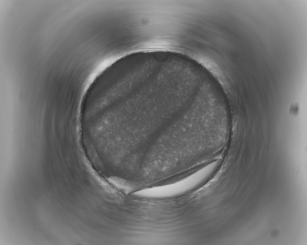 X0000093581469200711051108