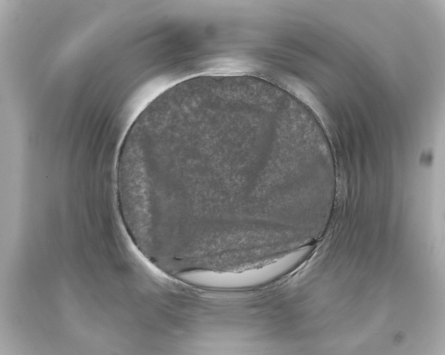 X0000093581487200711051108