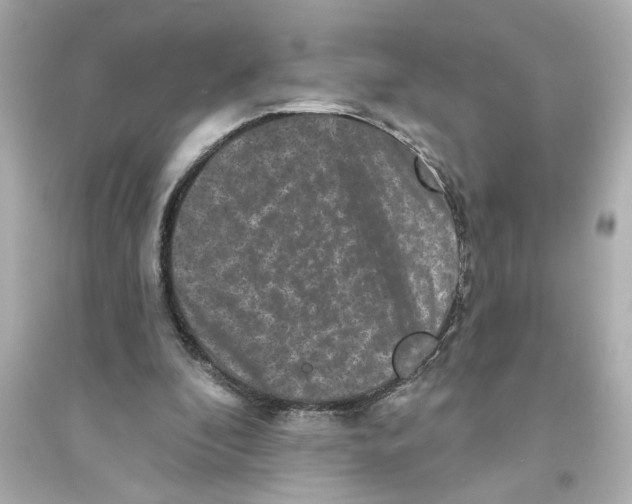 X0000093580296200711121107