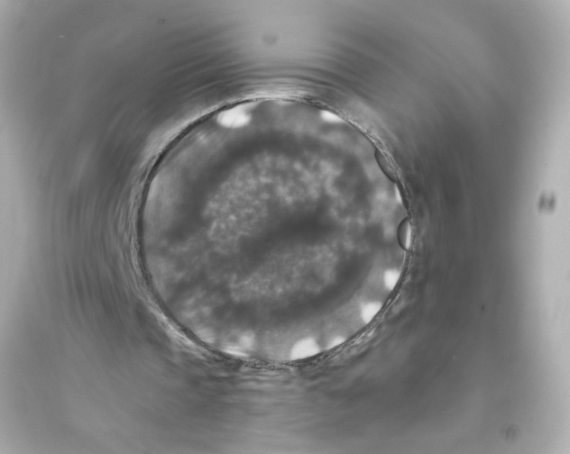 X0000093580337200711121106