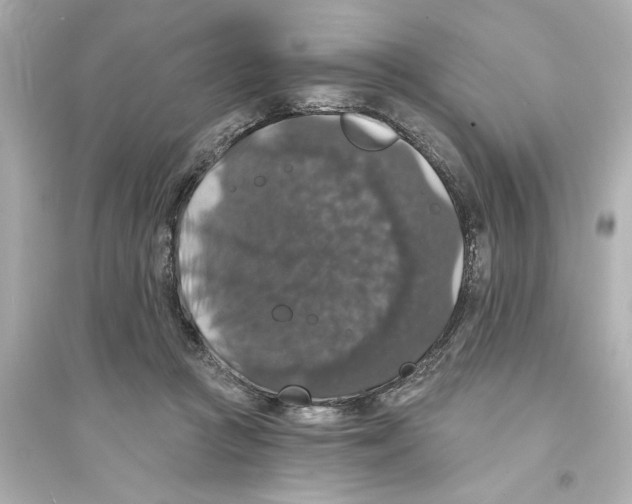 X0000093580361200711121106