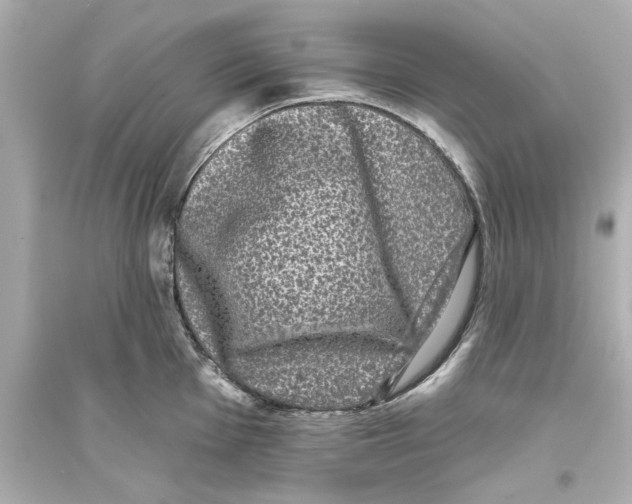 X0000093581001200711121056