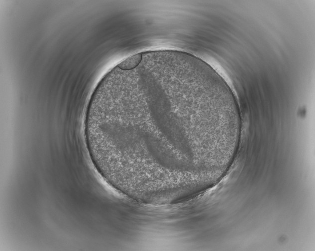 X0000093581197200711121053