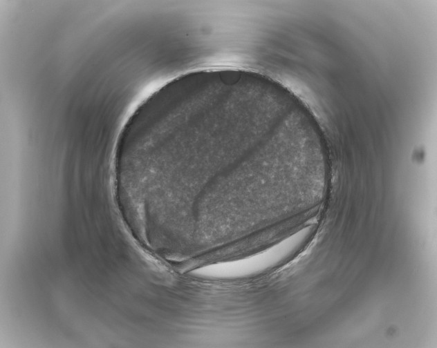 X0000093581469200711121049