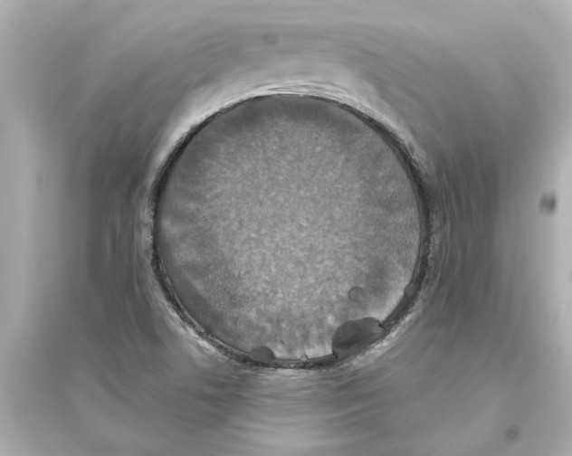 X0000093581506200711121048