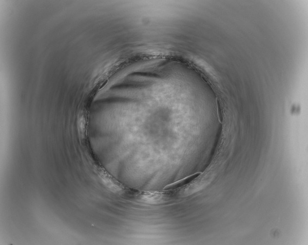 X0000093590720200710291122