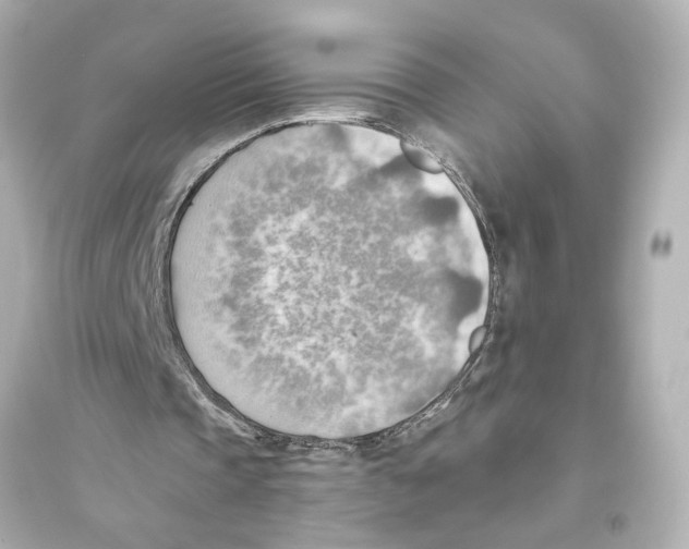 X0000093590337200711121130