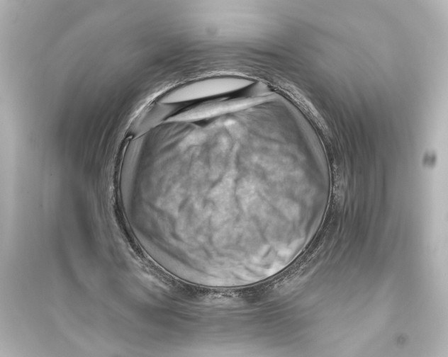 X0000093590386200711121130