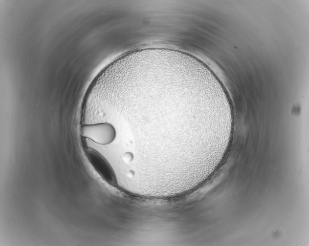 X0000093600957200711121145