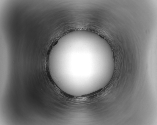 X0000093610720200710151016