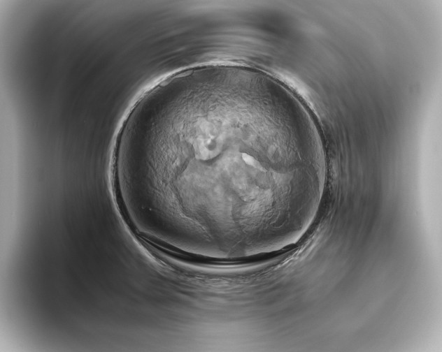X0000093611379200710151231