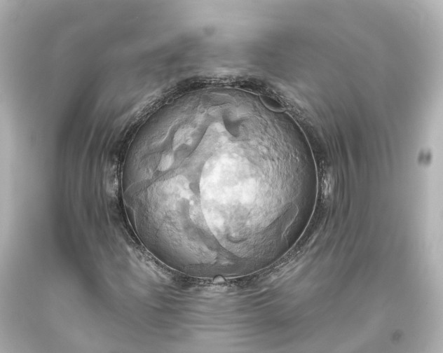 X0000093611204200710291158