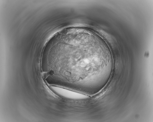 X0000093611417200710291155
