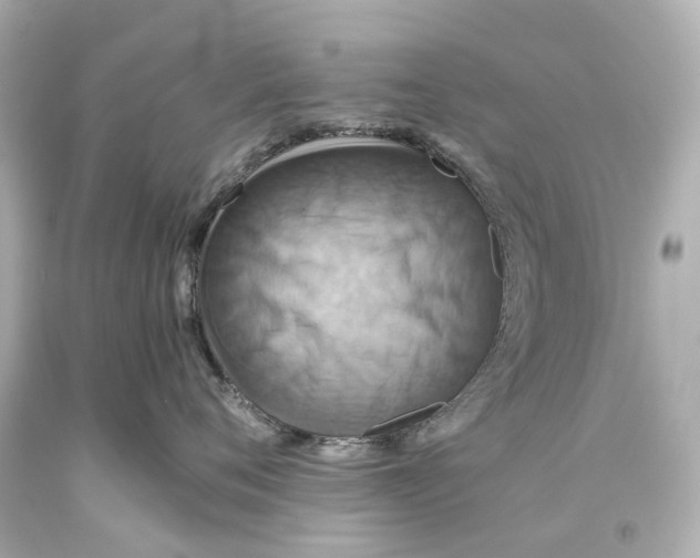 X0000093610720200711051219
