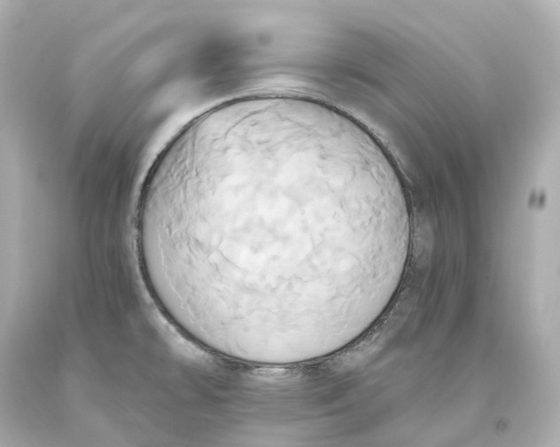 X0000093611478200711051209