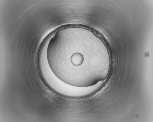 X0000093611069200711121207
