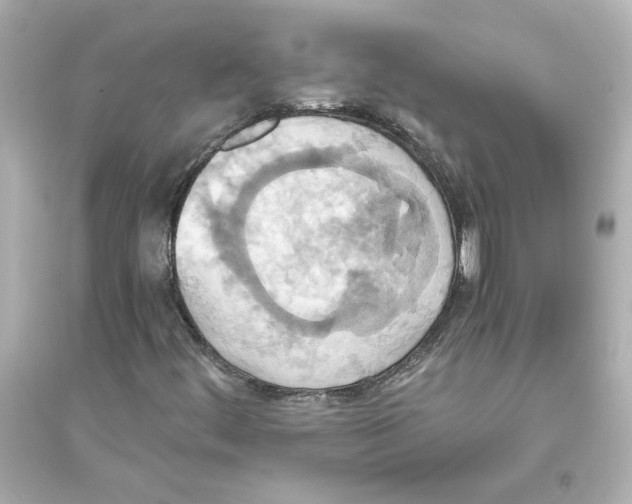 X0000093611444200711121201