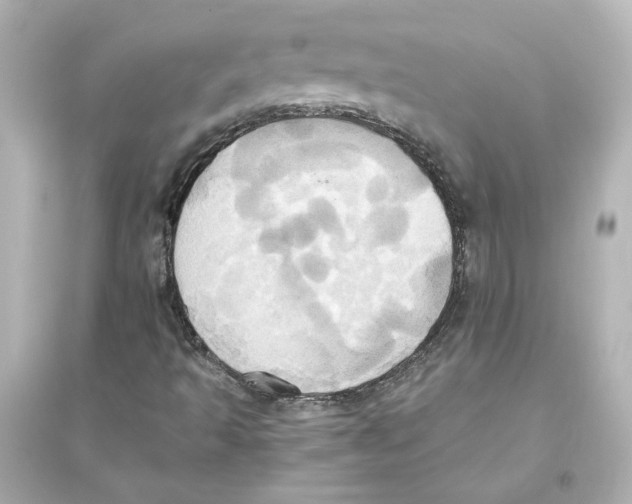 X0000093611493200711121200