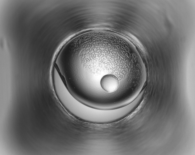 X0000093621196200710151255