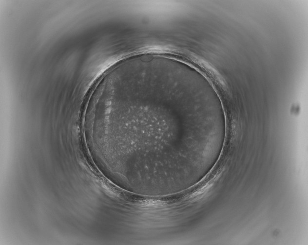 X0000093621170200710291220
