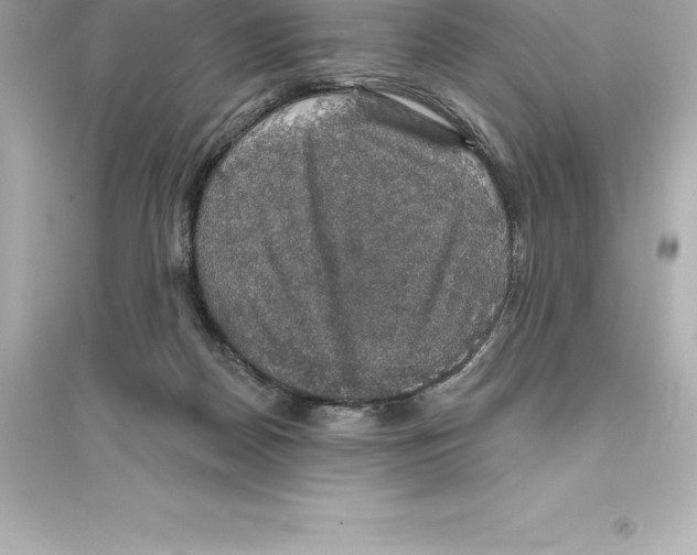 X0000093620170200711121244