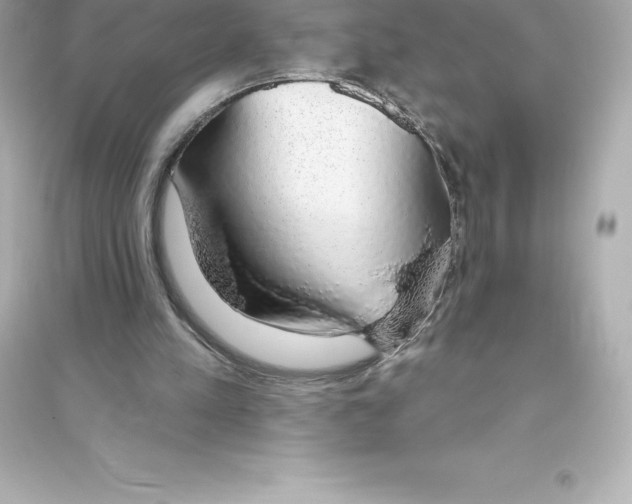 X0000093620197200711121244