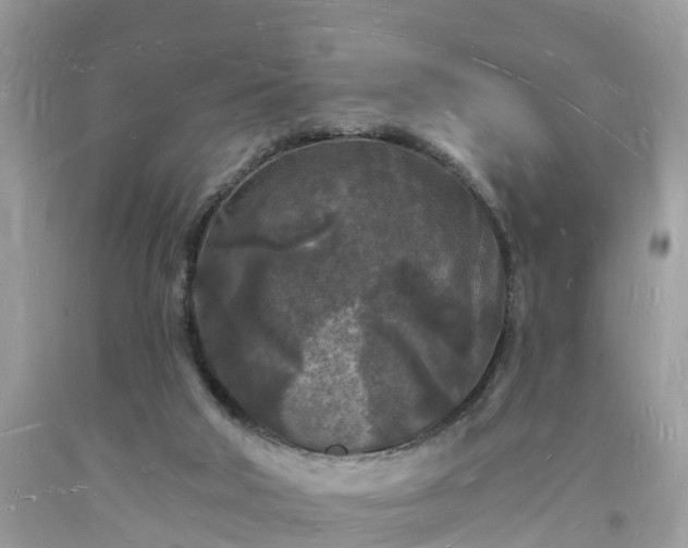 X0000093720018200710231141