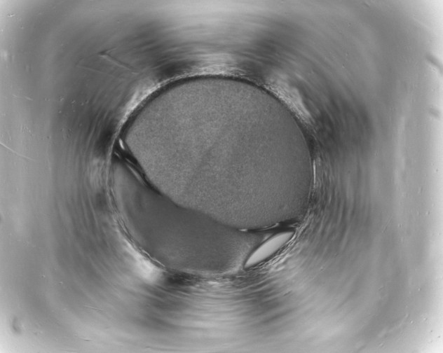 X0000093720156200710301031