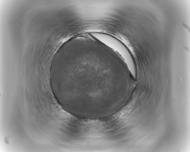 X0000093720385200710301029