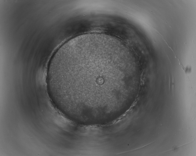 X0000093720146200711060945