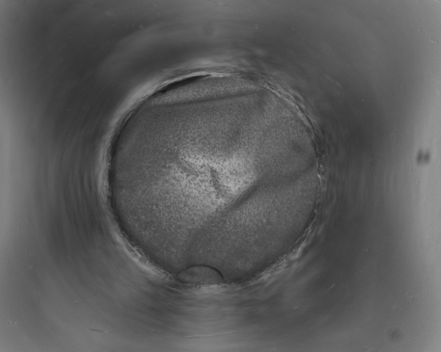 X0000093720149200711060945