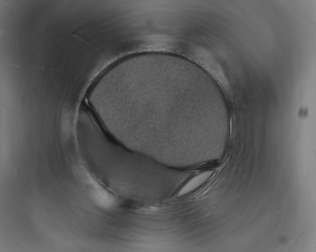 X0000093720156200711060945