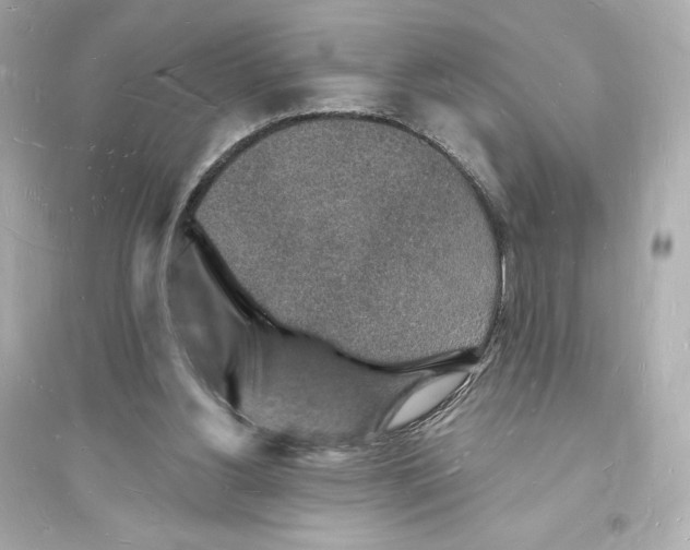 X0000093720156200711131022