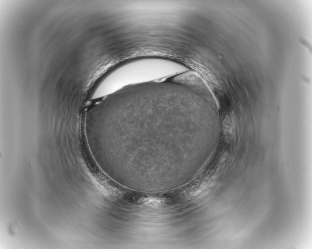 X0000093730352200710301048